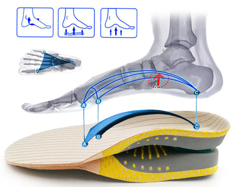 Ortopéd Pro Talpbetét Plantar Fasciitis Enyhítésére